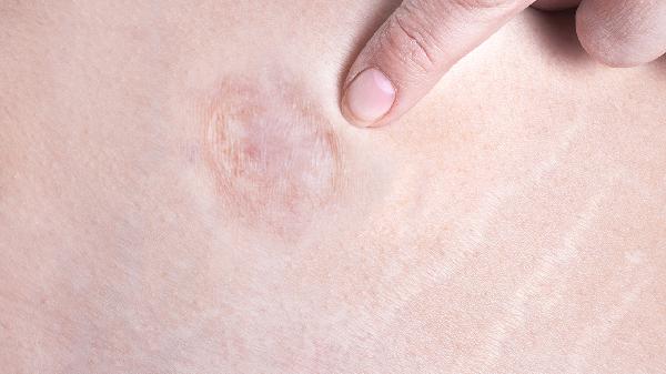 氨咖甘片对各种创伤性剧痛有效吗？