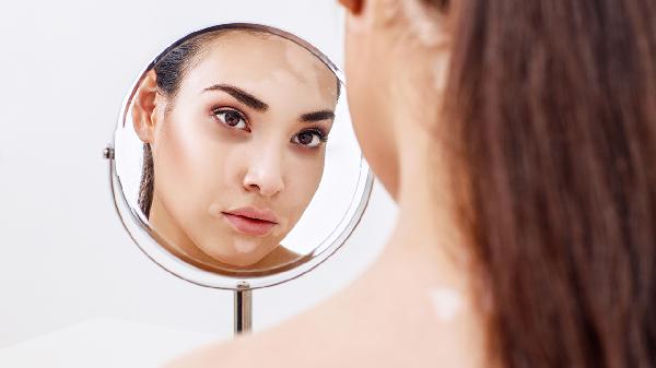 苏孜阿甫片治疗白癜风要禁吃哪些食物