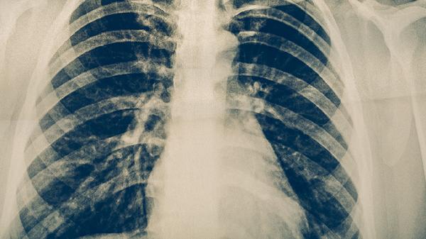 补肾斑龙片有什么成分功效?