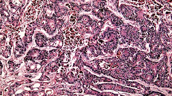 抗病毒颗粒能治疗小儿腮腺炎吗