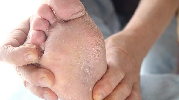 百癣夏塔热片对手癣起效快吗