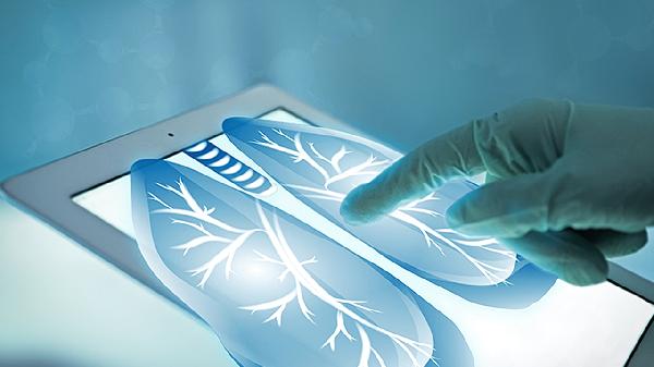 吃清肺散结丸给肺癌病人吃有效果吗