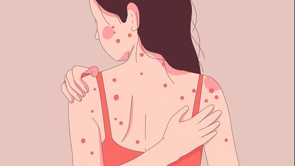 皮肤病血毒丸有效果吗