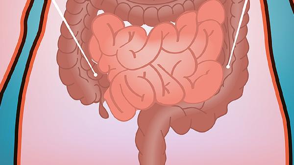 肠道清道夫+天然维C丸！超市冷门水果现在吃正当时