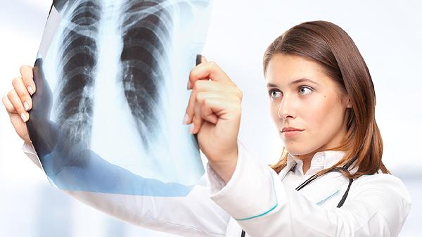 肺癌的隐藏症状大公开:除了咳不停,这些身体变化更要当心