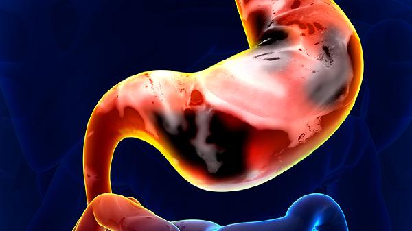 肿瘤标志物CEA升高是肠癌吗？