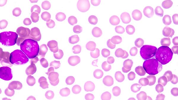 运动神经元能治吗