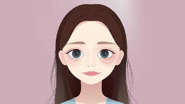 卧蚕没了是怎么回事