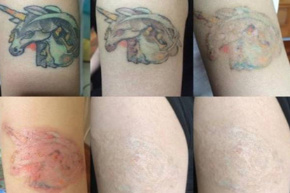 洗纹身后可以吃泡面吗