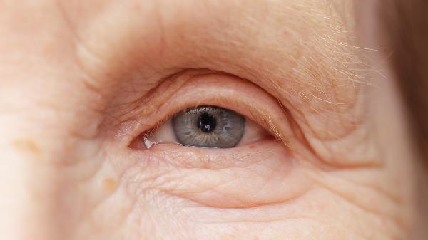 怎样才能去掉脸上的鱼尾纹