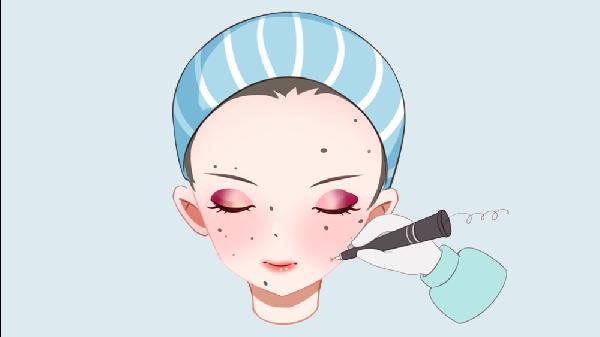 怎么去痣最快最有效的方法