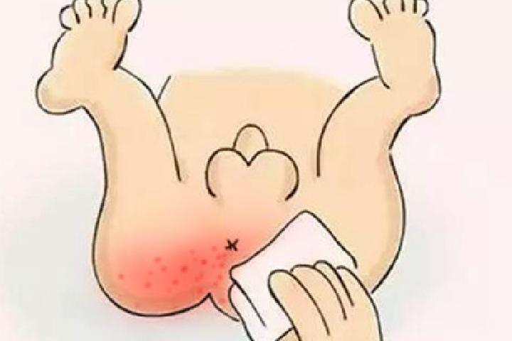 小宝宝白血病初期症状