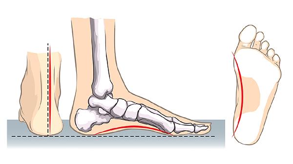 手脚麻木吃什么药最好