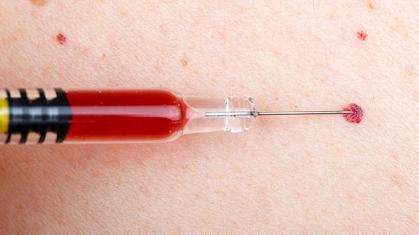 打针吃药下巴紫癜