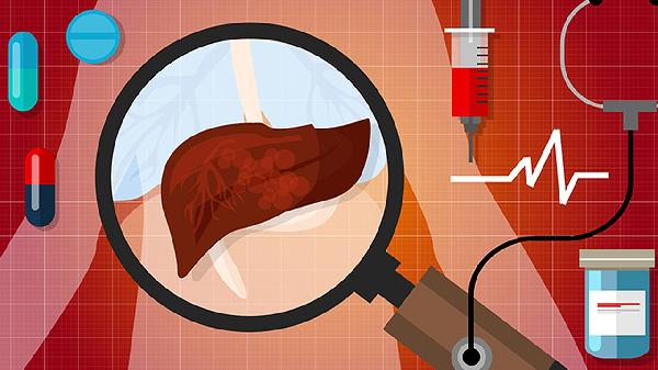 肝功能异常吃什么药好