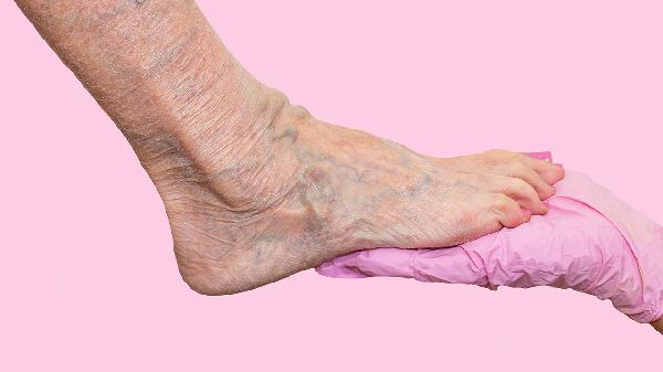 静脉曲张吃什么中药