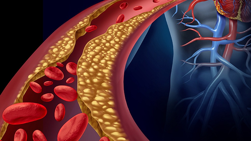 医生提醒:能活到80岁的高血压患者,大多在60岁,就不做这5事了