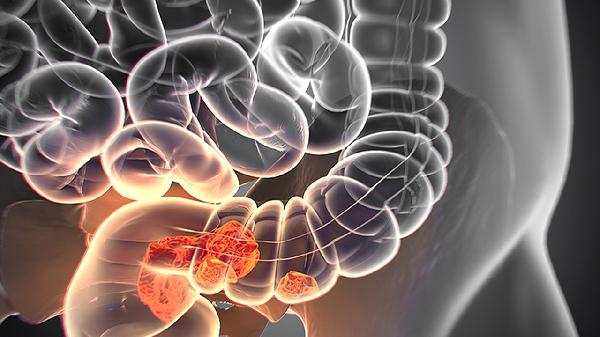 上午做肠镜几点喝药