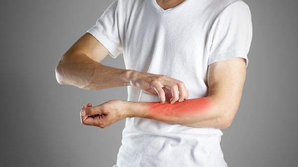有一种剧痛叫“带状疱疹”,用什么药好得快?这5类人尤其要当心