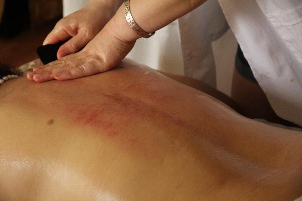 中医治疗便秘的方法有哪些