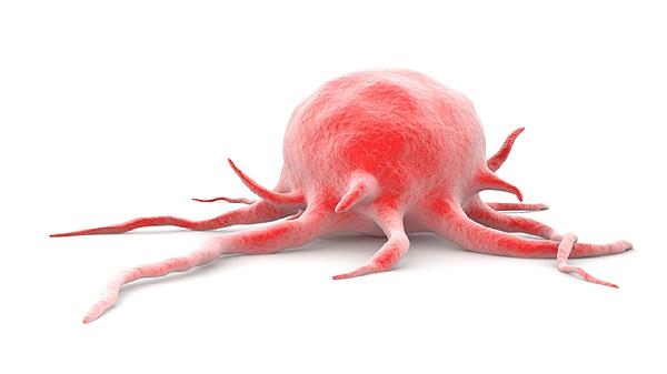 肿瘤标志物CA724升高是胃癌吗？