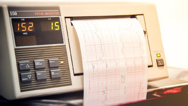 体检做心电图时手机要关机吗?