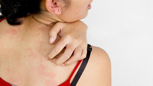 疱疹用什么药最快