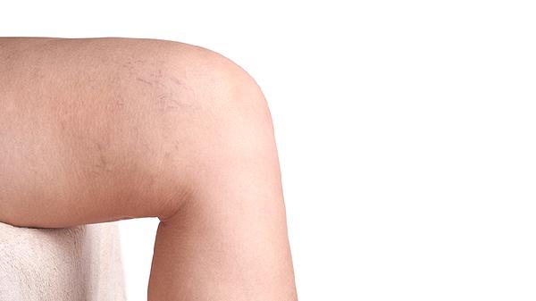 手关节疼痛吃什么药最好