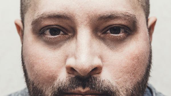 肾虚引起的黑眼圈吃什么药能治好