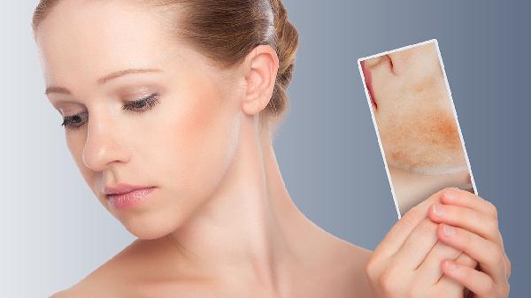 皮肤科有哪些护肤药物