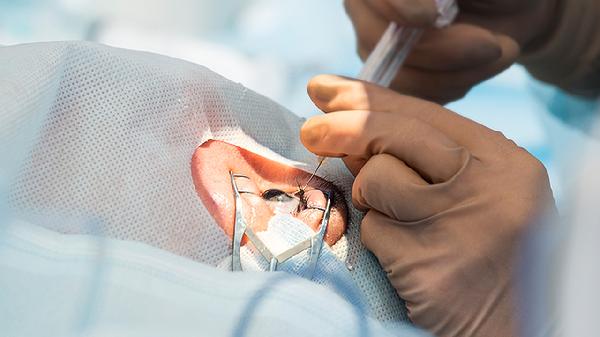 眼睛长了脂肪粒用什么药膏