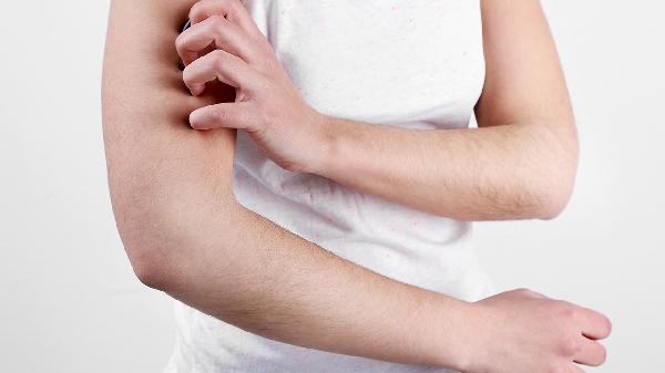 抗皮肤过敏的药有哪些该注意什么