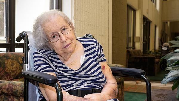 老人食管炎吃什么药好