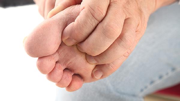 水泡型脚气用药怎样可以治脚气