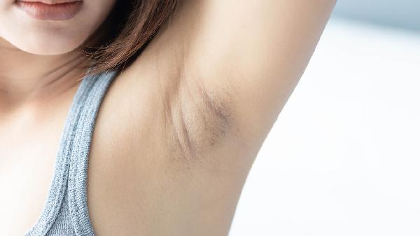 汗臭≠狐臭?医生科普腋下异味背后隐藏这些医学真相