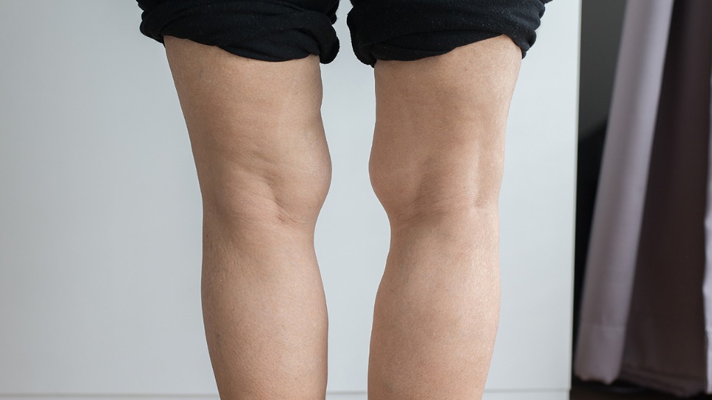 如果你有糖尿病神经,病变,下肢麻木疼痛,一定远离这4种饮食习惯