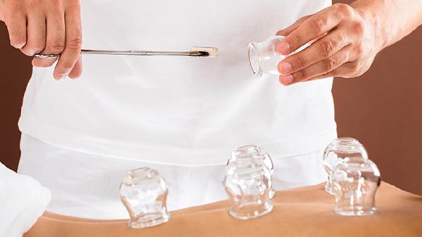 如何利用拔罐减肥呢