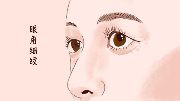 怎样消除眼角细纹