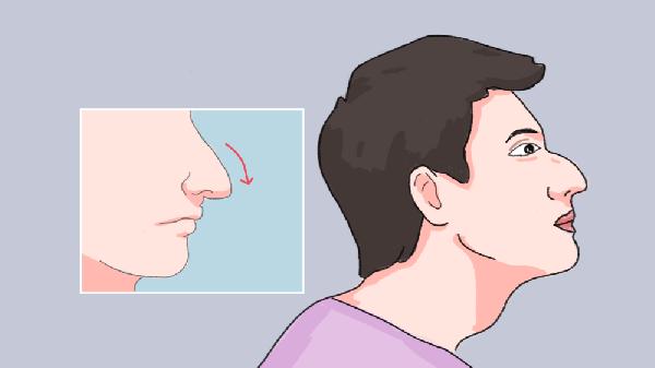 什么是鼻部整形手术