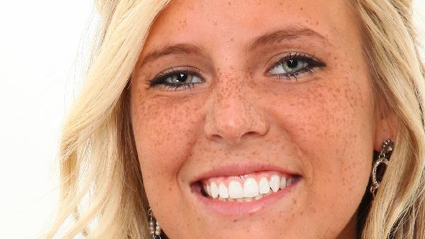 怎么分辨雀斑和黄褐斑