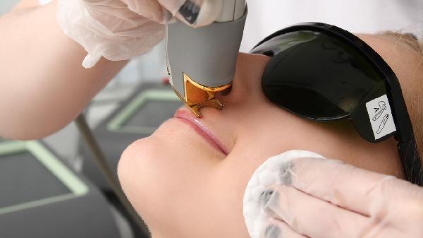 脱唇毛后会不会再长