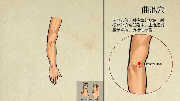 中医刺络放血疗法
