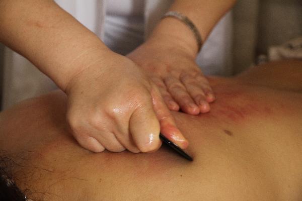 中医治疗腺样体肥大有哪些优势