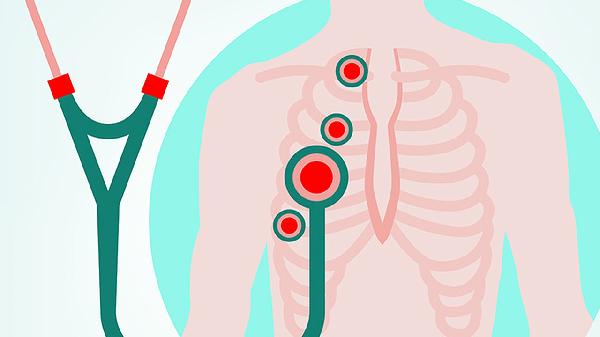 清肺十八味丸作用与功效