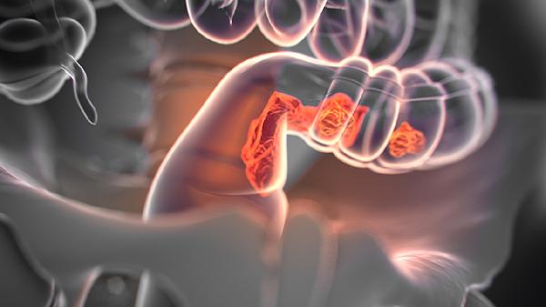 硫普罗宁肠溶片的功效有哪些