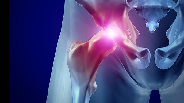 骨骼风痛片的作用都有哪些