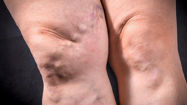 官方旗舰店护肝片口碑推荐，护肝片哪个牌子效果好？专为脂肪肝酒精肝特研产品清单