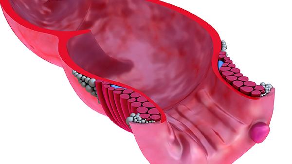 血管堵塞有什么办法可以疏通