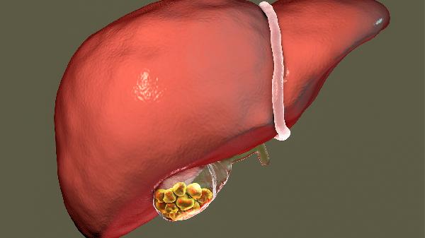 胆囊恶性肿瘤能治好吗