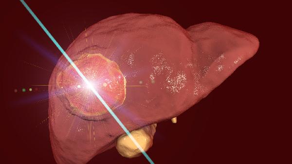 肝胆病症状有哪些